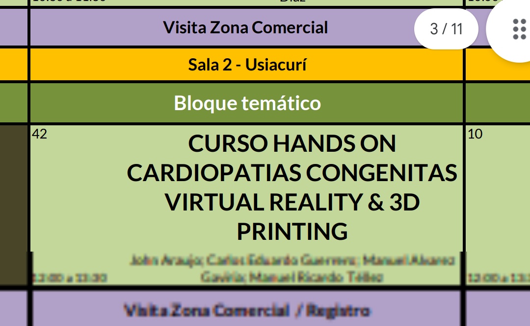John Jairo Araujo. MD, NBE, FSIAC, FSISIAC, FACC (@johnjairoarauj1) on Twitter photo Mañana inicia el congreso colombiano de cardiología y cirugía cardiovascular <a href="/sccccardio/">Sociedad Colombiana de Cardiología</a>
Inicio de taller en #ACHD 3D print realidad virtual
Anatomía normal, ASD, Fallot, Swicht atrial y más..
<a href="/Ecoimagenescc/">Cap.EcocardiografiaSCC</a> Mañana inicia el congreso colombiano de cardiología y cirugía cardiovascular <a href="/sccccardio/">Sociedad Colombiana de Cardiología</a>
Inicio de taller en #ACHD 3D print realidad virtual
Anatomía normal, ASD, Fallot, Swicht atrial y más..
<a href="/Ecoimagenescc/">Cap.EcocardiografiaSCC</a>