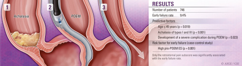 GIE (@gie_journal) on Twitter photo Vauquelin et al detail “Factors associated with early failure of peroral endoscopic myotomy in achalasia." giejournal.org/article/S0016-…
<a href="/bergerarthur7/">arthur berger</a>
<a href="/DrMohdZein/">Mohamad El Zein MD, MPH </a> Vauquelin et al detail “Factors associated with early failure of peroral endoscopic myotomy in achalasia." giejournal.org/article/S0016-…
<a href="/bergerarthur7/">arthur berger</a>
<a href="/DrMohdZein/">Mohamad El Zein MD, MPH </a>