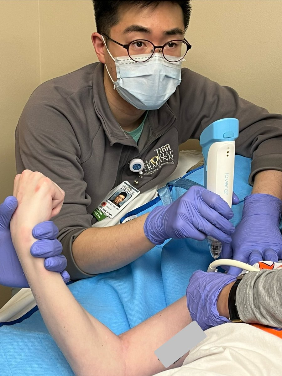#spasticity case of the day. BIM Fellow Dr Chi had another successful case of #cryoneurolysis. Still need to take care of elbow flexor tendon contracture. #TIRR @UTHPMR @drpaulwinston @drmaryerussell