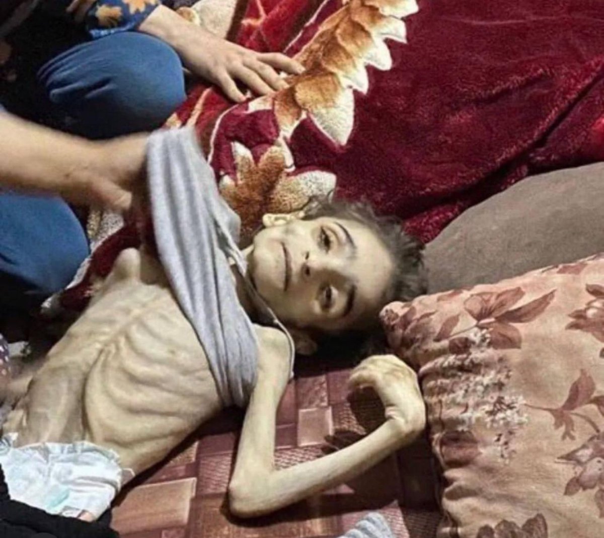 CHILDREN ARE STARVING THIS IS NOT GERMANY 1943 IT IS GAZA 2024