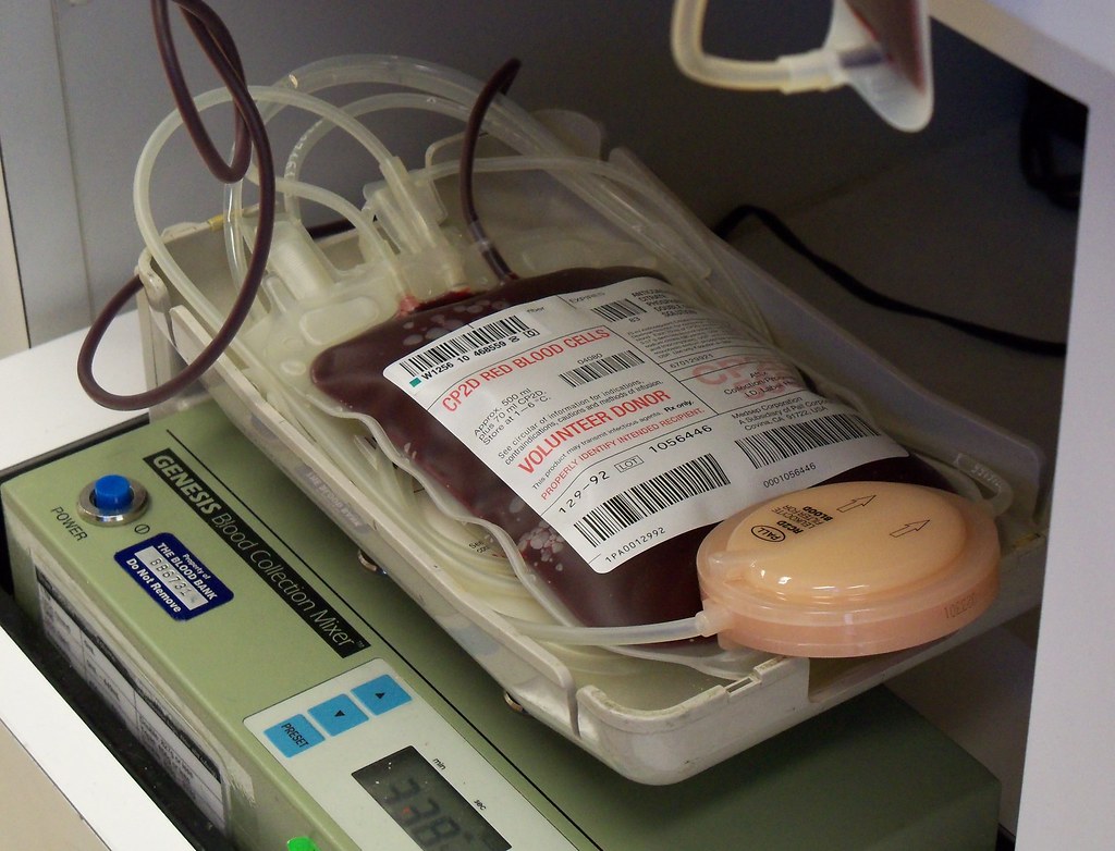 Researchers shed light on the potential connection between allergic transfusion reactions and food allergies @ShinshuUni #university #research #allergy shinshu-u.ac.jp/english/topics…