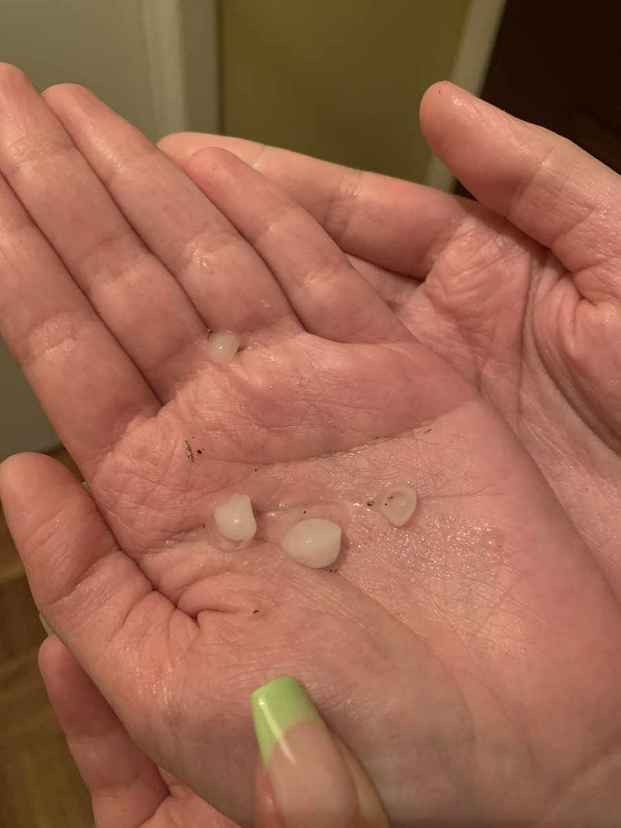 KorianR's tweet photo. Pea-sized hail in Leavenworth, KS. Also, I got the chance to meet Nick Bender today!⛈️ https://t.co/UB0CRNhXTq