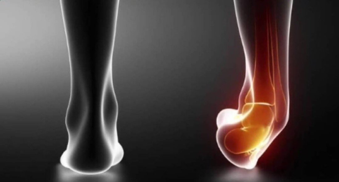 invis4yo's tweet image. *walking on a completely smooth path*
my ankle: