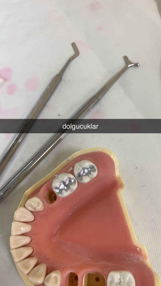 ilaydaayucelll's tweet photo. ben bugün ilk dolgumu yaptımm🥰🦷 https://t.co/IsifaAFQVM