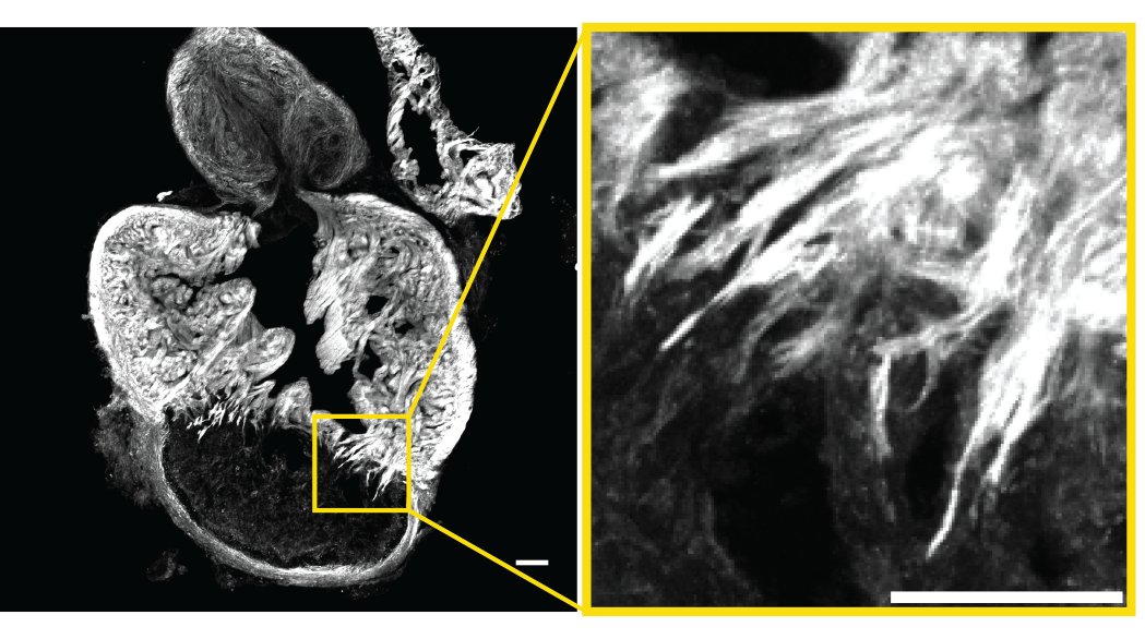 Very excited to share the first Beisaw lab preprint! biorxiv.org/content/10.110… We analyze the process of cardiomyocyte protrusion and invasion into injured tissue during #zebrafish heart regeneration using histological and live-imaging approaches, 1/