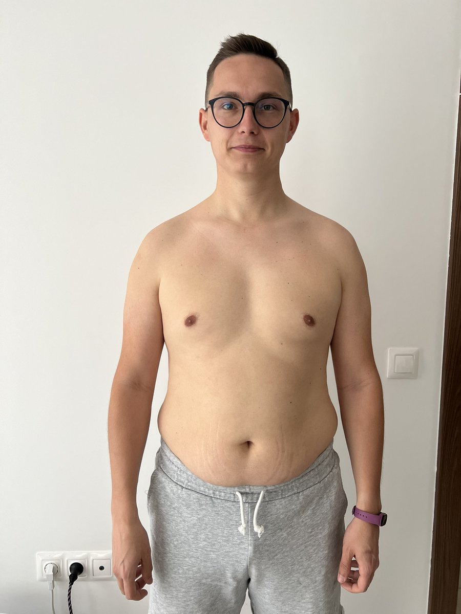 Florin Pop 👨🏻💻 tweet media