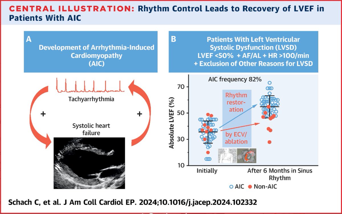 Our published trial: High prevalence & recovery of AF-Induced Cardiomyopathy in patients with AF&unexplained HF(m)rEF Come rain or shine: #SinusRhythm jacc.org/doi/10.1016/j.… @JACCJournals @nmarrouche @AGEP_DGK @Phiso_de @dirkwestermann @dzhk_germany @DGK_orgClinical @chris_sohns