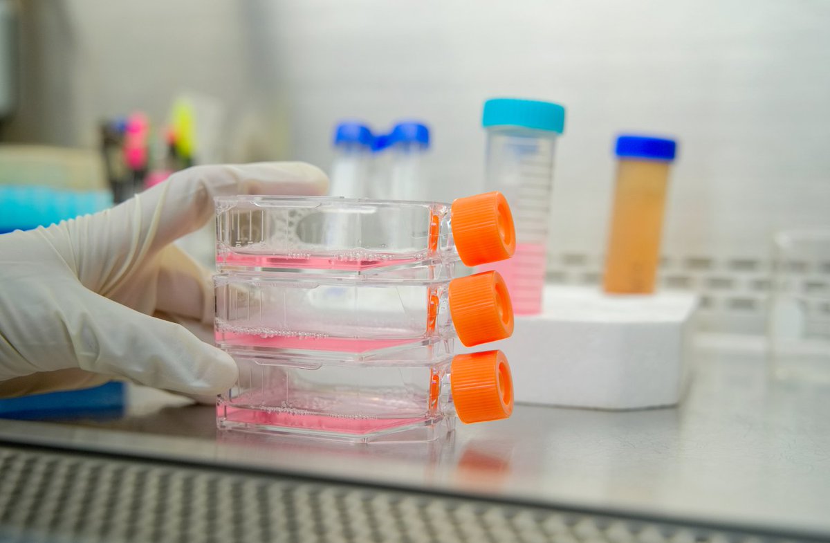 PremiumXRemark's tweet photo. To find out what goes wrong in #MND #ALS researchers will often use models of the disease.

One way to do this is to grow cells in a dish. 🧫

@Drbenpchall discusses how researchers are now able to create 3D models in our new blog ⬇️

https://t.co/ahvFJvne0z https://t.co/sZxImVsqev