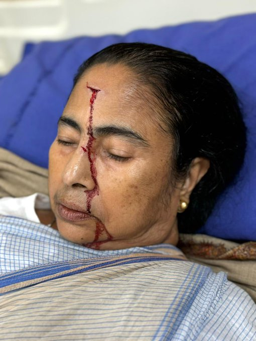 TimesNow's tweet photo. "Our chairperson @MamataOfficial sustained a major injury. Please keep her in your prayers 🙏🏻..." tweets All India Trinamool Congress.

#MamataBanerjee #WestBengal https://t.co/XwgP3rL0JJ
