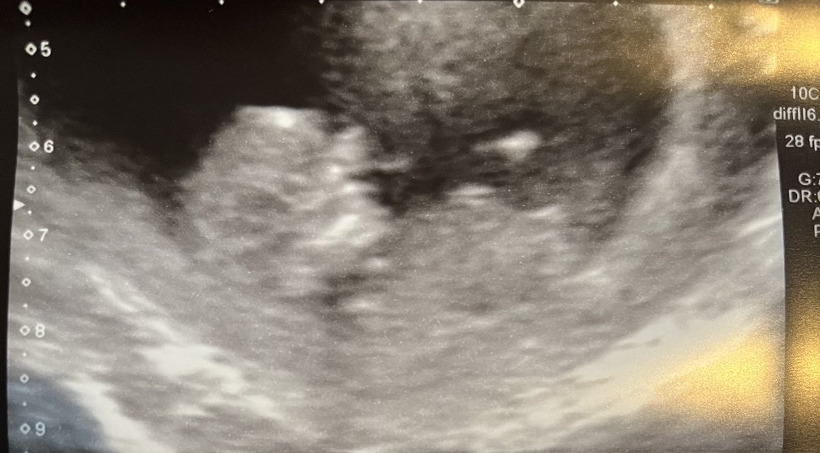 Saify14_'s tweet photo. So we have a predicament 
The baby is due on the 29th September. 
EAFC 25 normally releases the same day 😂
Absolutely buzzing to the moon, WE ARE HAVING A BABY ❤️

LETS COOK 🔥 https://t.co/oncTjS5kYB