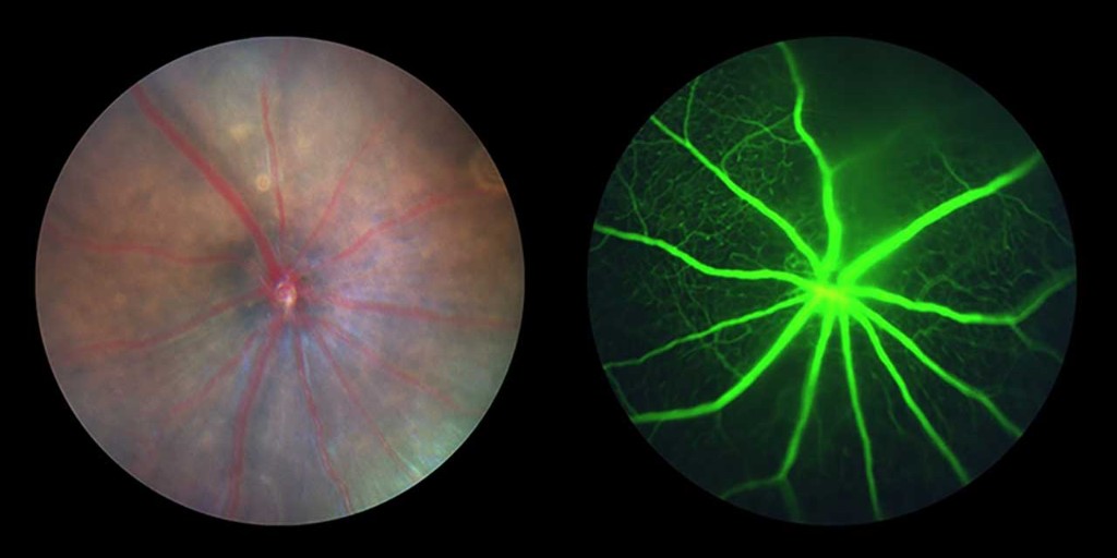 Globally, over 200 million people are impacted by age-related #maculardegeneration, a leading cause of blindness in older adults.  #Genetherapy research from #biotech innovator @Oculogenex aims to prevent or even reverse #AMD symptoms. #CRS30
Details: ow.ly/Izcu50QTjxo