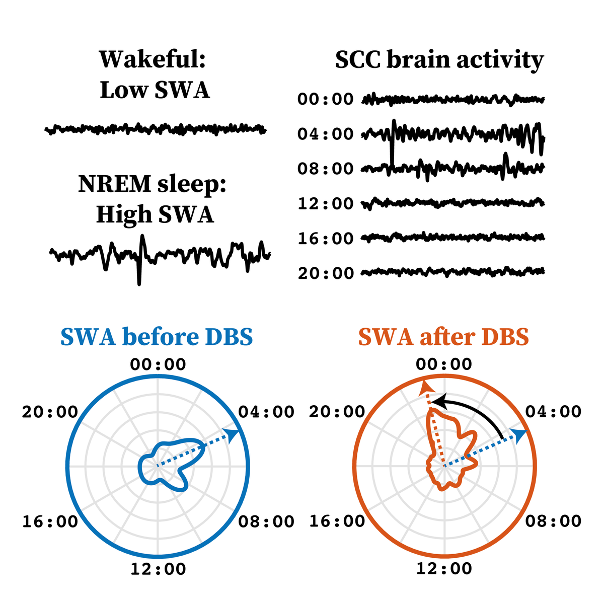 MRCBNDU's tweet photo. New Unit Paper in @Transl_Psych on the effect of deep brain stimulation in depression on cortical signatures of sleep

https://t.co/D6lG5cZFk9

@MRCBNDU  @NDCNOxford  @UniofOxford https://t.co/pBmNkwv6OL