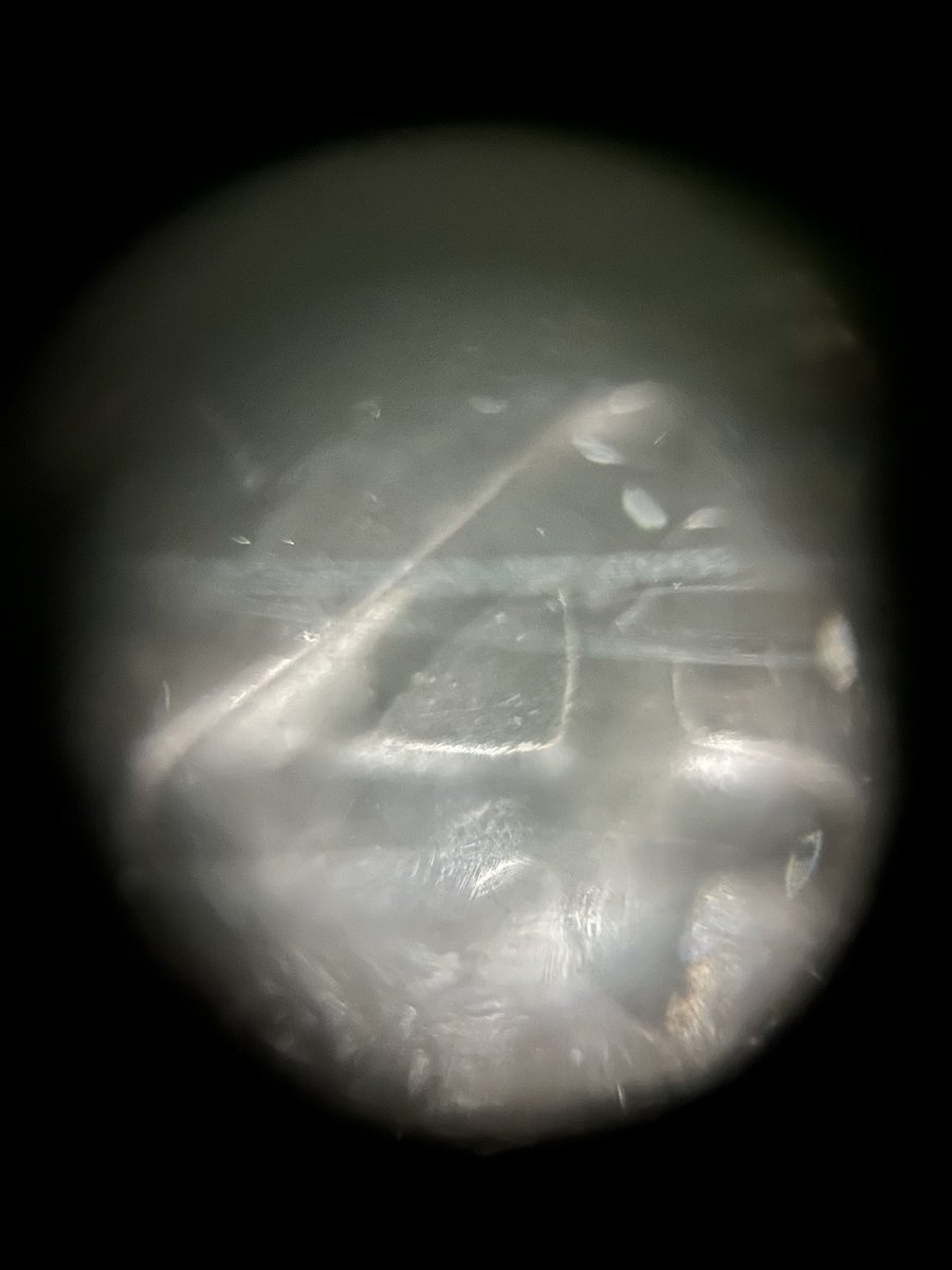 Happy π day!

<a href="/BoutiqAcademia/">Boutique Academia</a> π necklace

Images captured with <a href="/TeamFoldscope/">Foldscope</a>’s Foldscope 2.0 using reflective lighting

#microscopy #STEAM #ScienceIsFun #MathIsFun #FearlessMicroscopy