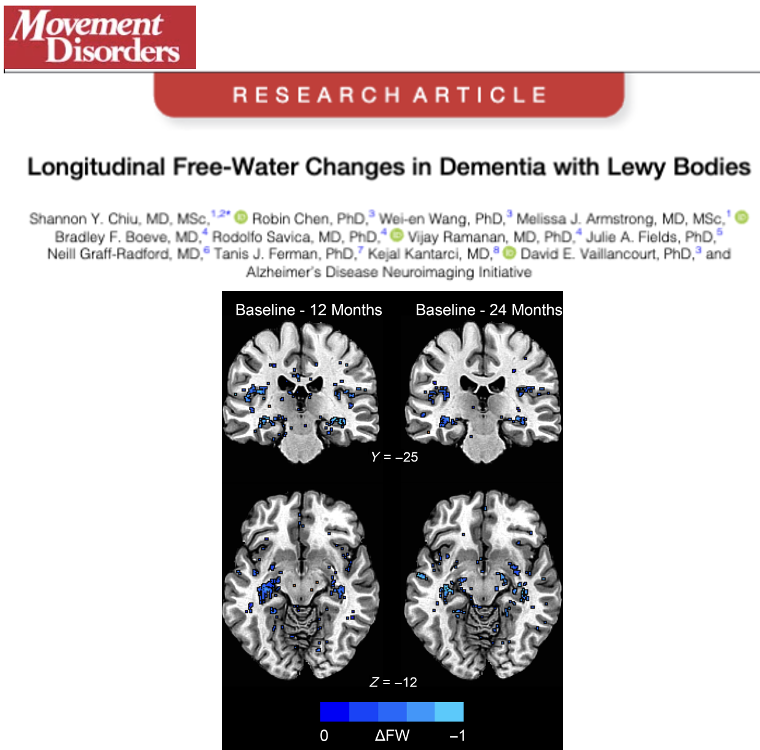 Can you track disease progression in Dementia with Lewy Bodies using diffusion-weighted MRI and specifically free water? According to Chiu, Vaillancourt @FixelInstitute and the Alzheimer's Disease Neuroimaging Initiative the preliminary answer is YES. Read their new article just…