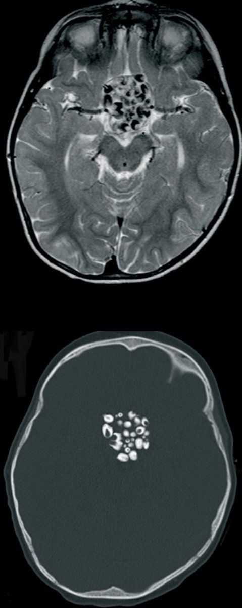 How you say TEETH in BRAIN?