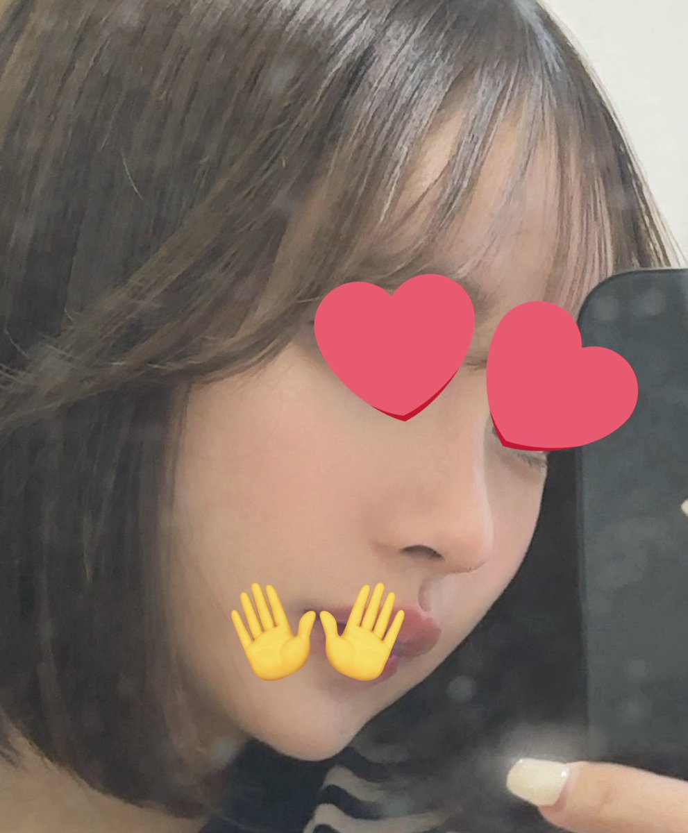 dpql32's tweet photo. アーバンさん(@prs_urban )で鼻フル、頬顎下脂肪吸引、目の下脂肪再配置をして6ヶ月経ちました^.ˬ.^ 周りから鼻を褒められることが多くてうれしい！最初は高すぎたかな?って思ったけどどんどん馴染んで綺麗になってて大大満足です(   ߹ㅁ߹)🤍🌟 https://t.co/26aw5Gfv4m
