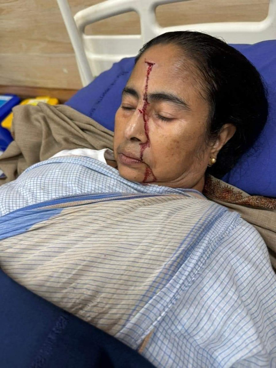 Calcutta_News's tweet photo. Severely injured Chief Minister Mamata Banerjee , taken to SSKM Hospital

Trinamool Congress
West Bengal Chief Minister Mamata
Banerjee suffered major injuries to her
forehead #MamataBanerjee https://t.co/79ir0YNm3k