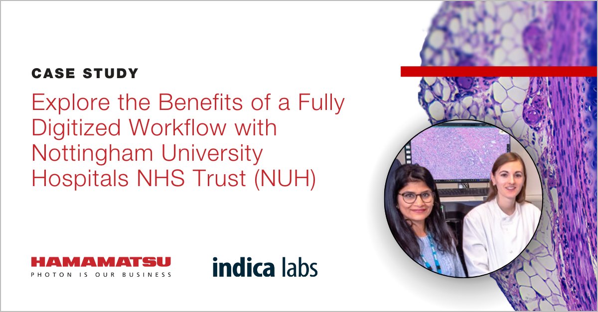 Ever wonder if #digitalpathology is revolutionizing pathology workflows in healthcare?

Dive into our latest case study showcasing Nottingham University Hospitals NHS Trust's digital pathology journey. Read it here: ow.ly/KUI950QSLfx 

#IndicaLabs #NanoZoomer