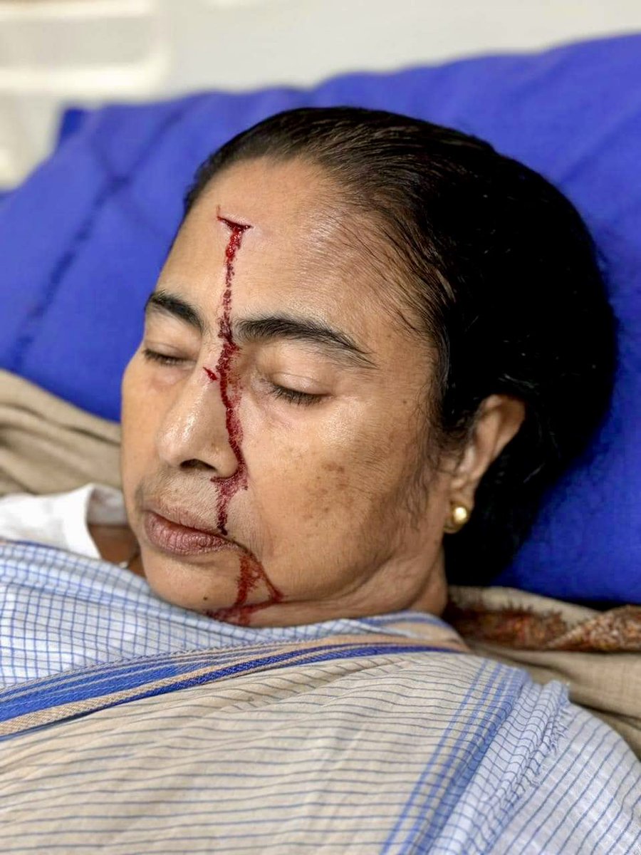 abhijitmajumder's tweet photo. CM lies unattended, without even first aid, as blood streams down her face.
This despite a doc team being with her 24x7.
Is it the terrible state of medical care in Bengal or the stellar standard of drama and performing arts?
PS: Backdrop is TMC blue and white.
#MamataBanerjee https://t.co/GZvsIKvm3q