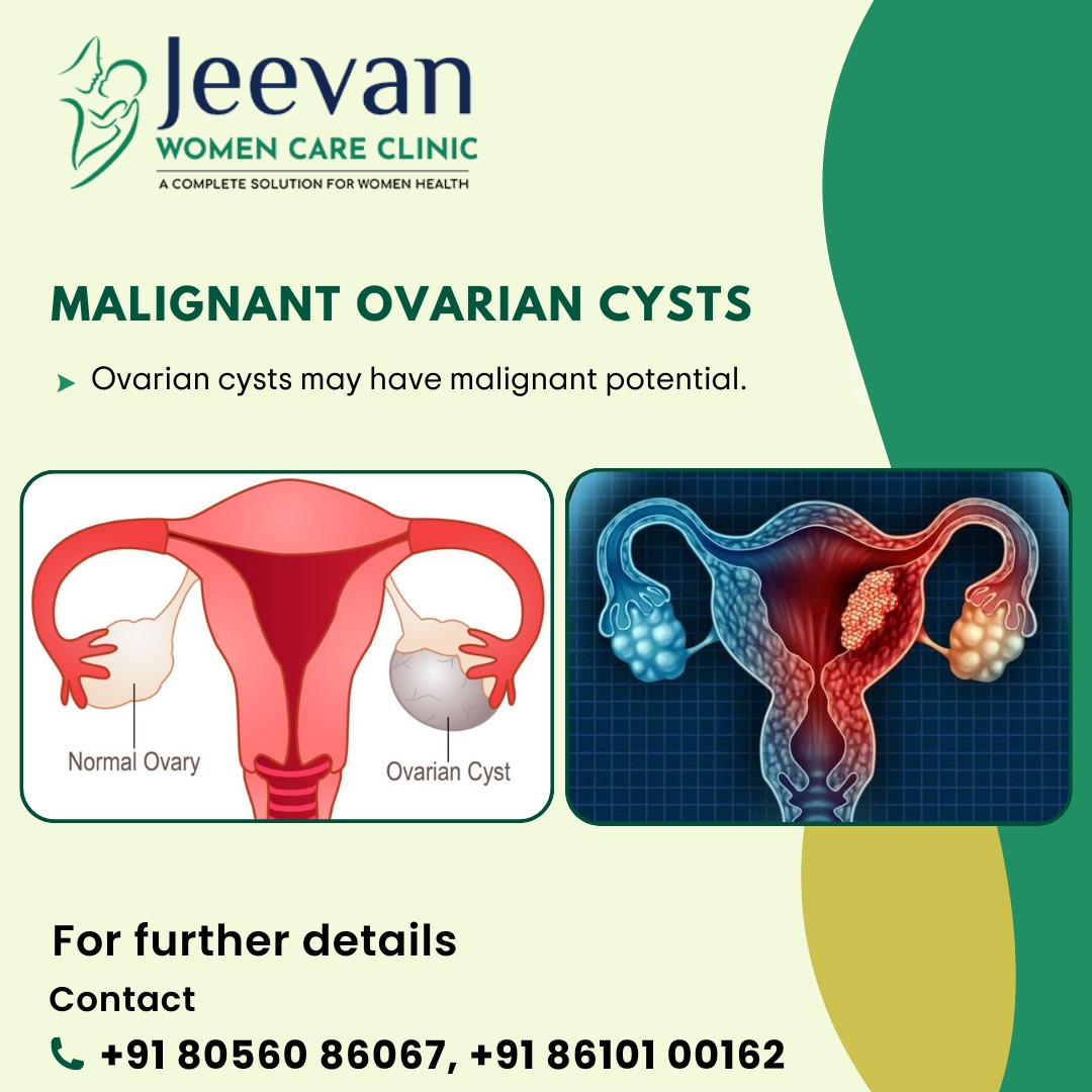 Don't ignore ovarian cysts as they can turn malignant. Consult a gynecologist for personalized assessment and management.Your health matters! #ovariancysts
#jeevanwomencare #jeevanwomencareclinic #drsasirekha #drkumaran #IUI #FertilityJourney #TryingToConceive #FertilityTreatment