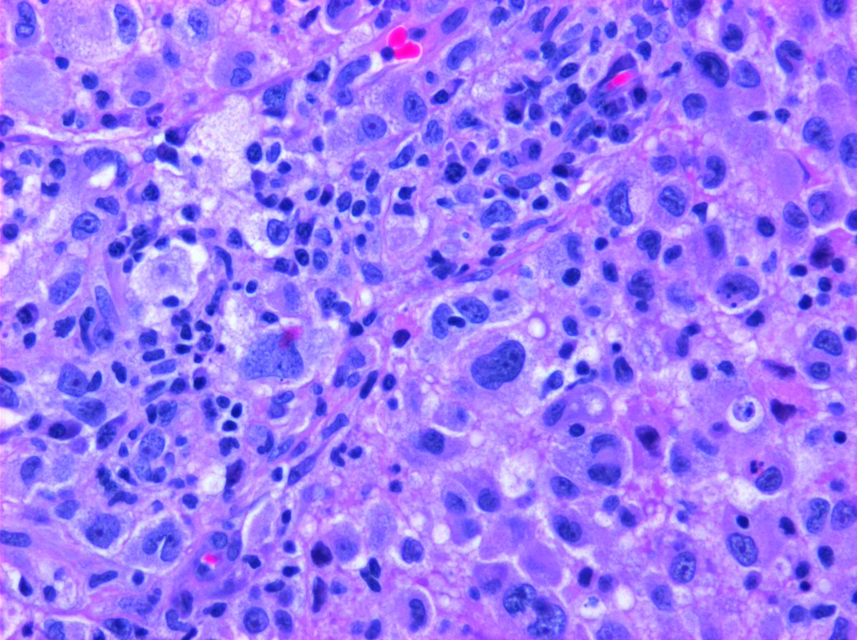 @Hemepathguy tweet media