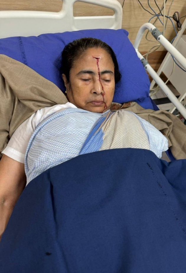 What worries me is the absolute careless attitude of the doctors at the hospital. Why have they not cleaned up blood off #MamataBanerjee ‘s face? Why are they allowing blood to flow from her forehead all the way down to her chin and below? I want the Medical Association of