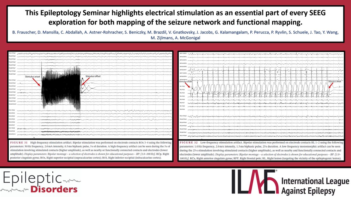 Epileptic Disorders tweet media