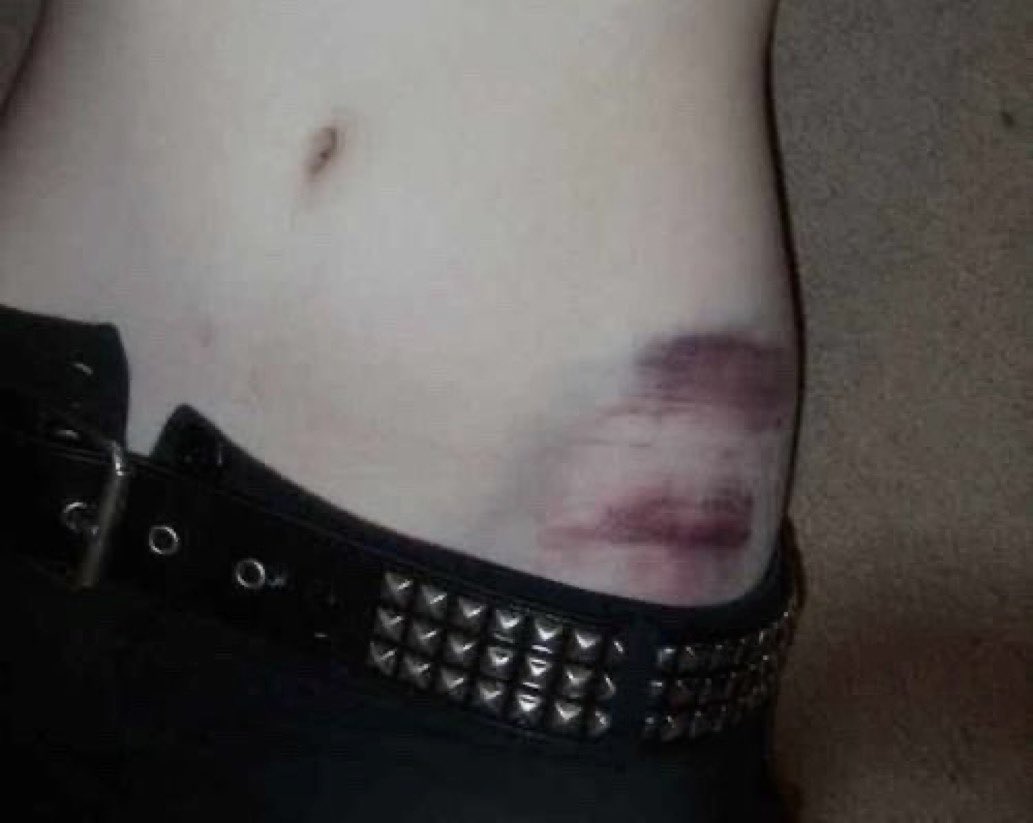 ;x (@pillbottlez) on Twitter photo 