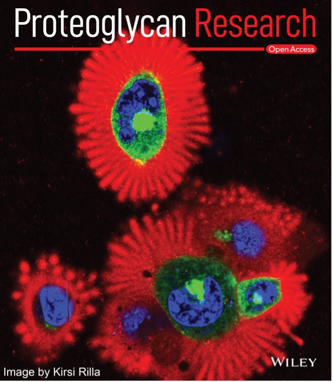 PGResearch_'s tweet photo. Dear PG lovers, a  new research paper from the team of the Ronzoni Institute in Milan has generated a novel functionalized hyaluronan, HYLACH® , that binds &amp; suppresses Galectin‐3 function, offering a new tool  to combat idiopathic pulmonary fibrosis.  
https://t.co/88ZIU6ZR4X https://t.co/UhnvzBLYu6