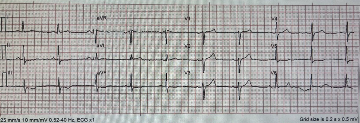 Tom Bouthillet tweet media