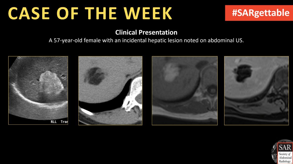 It's time for a new #SARgettable case of the week contributed by @AndreaEsqXR. Comment with your diagnosis down below!