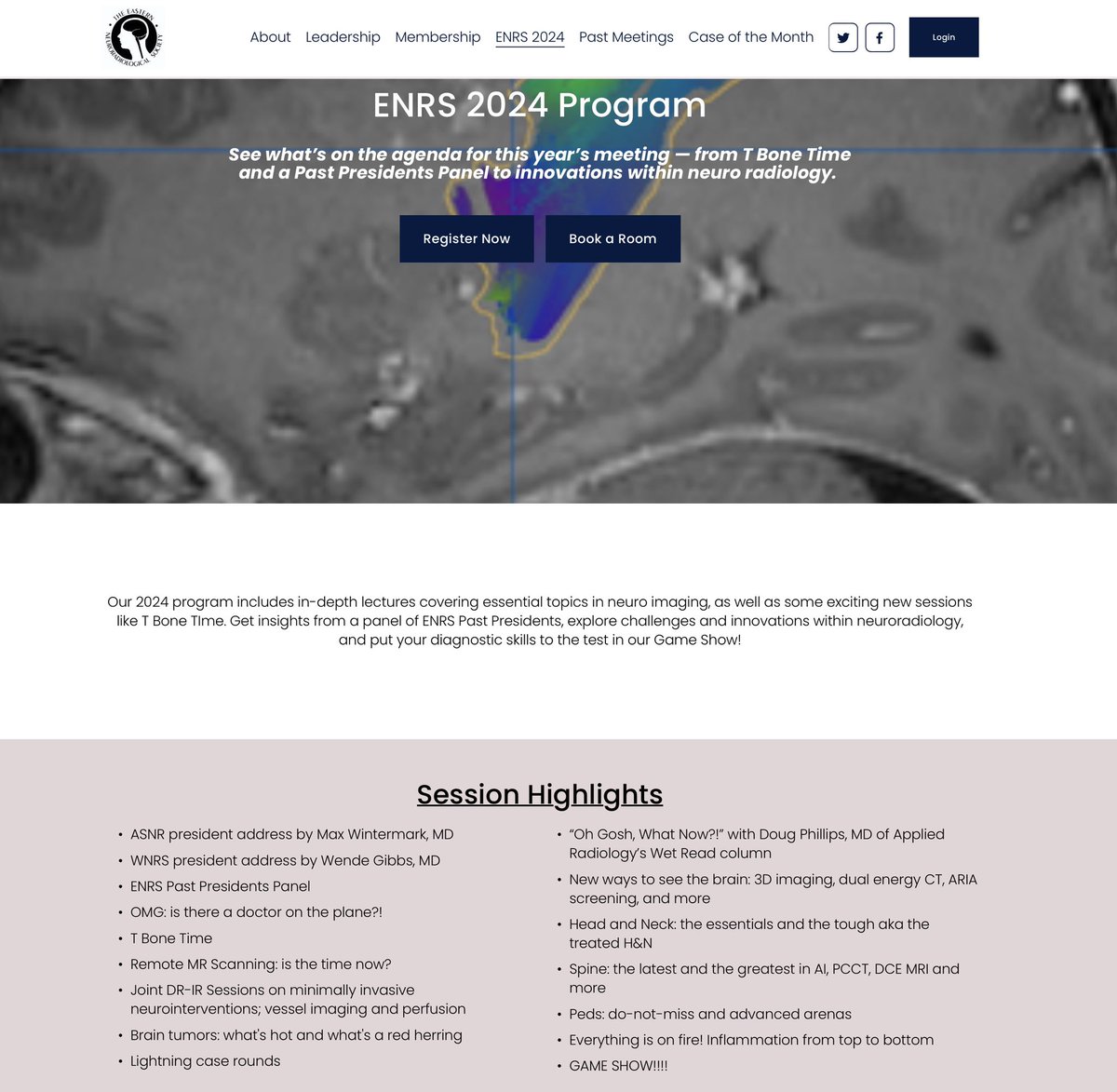 Can’t wait for this meeting! (already registered and hotel booked to see my favorite @amyfjuliano 😁). Amazing program and location! @TheENRS @wnrs2023 #neurorad