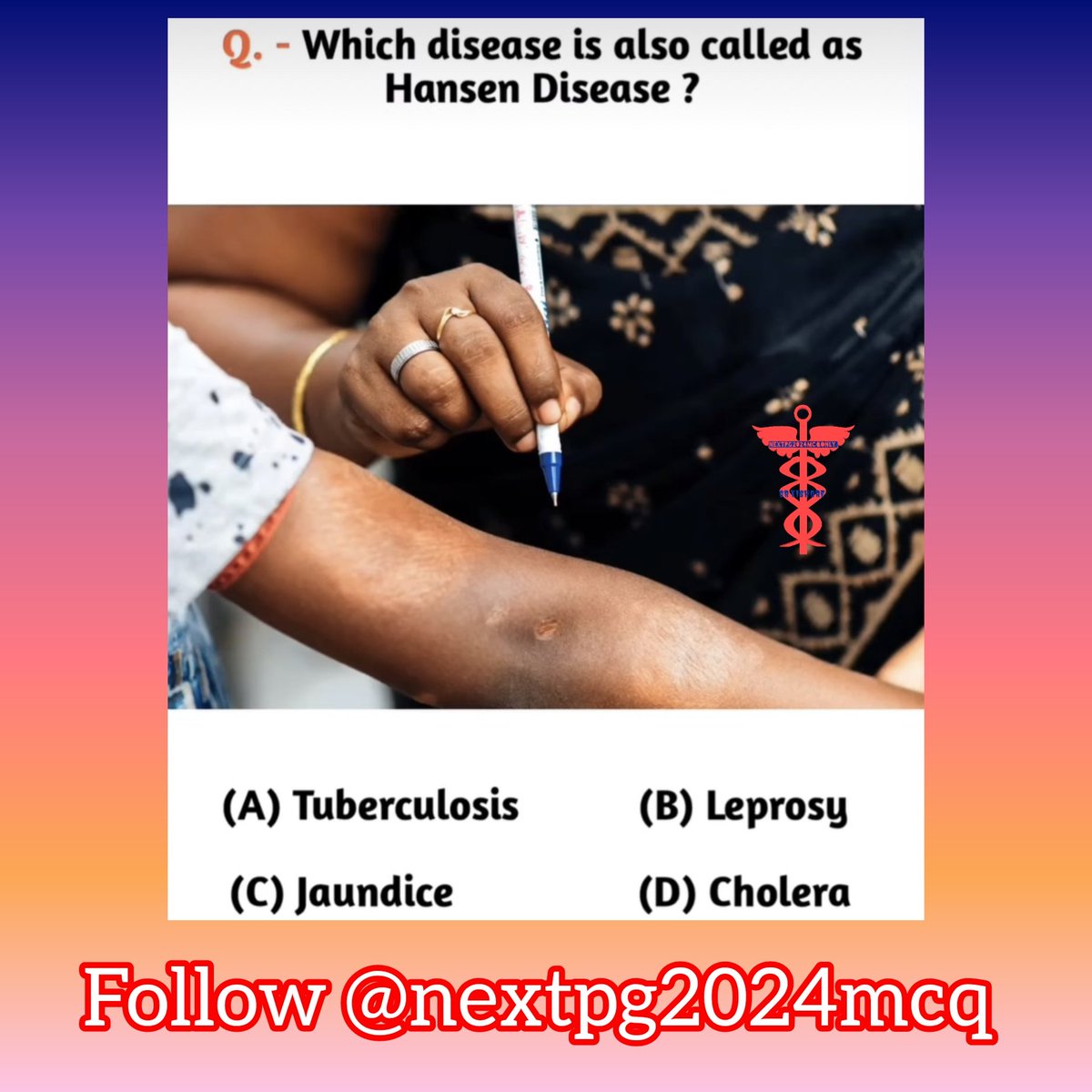 24ptka's tweet image. SURE SHOT NEET PG PYQ 15.
ANSWERS &amp;amp; DISCUSSIONS IN COMMENTS👇👇 #NEETPG2024 
#fmge2024 
#nextpg 
#inicet2024 
#medico
#neetpg
#medicine