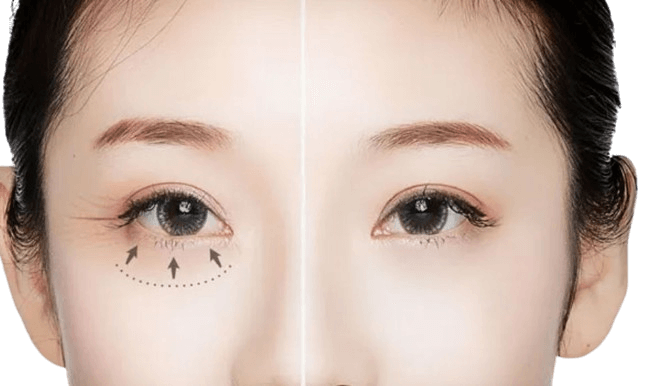 Can an eye massager remove eye bags?
fujireja.com/can-an-eye-mas…

Written by: Sandy from FUJIREJA Group
The Exporter and Manufacturer of Massage Chair and Massager since 2003
Welcome OEM or ODM
fujireja.com

#eyemassager #bodymassager #facemassager #neckmassager