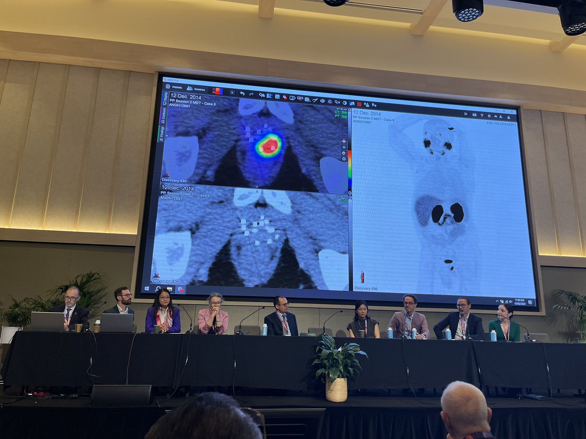 MDT discussion alive cases with @mimsoftware #prostic2024 rocks!! @urotoday @DrJaVallejo @julired3 @cdanicas @dandanmena @DrMHofman @drlouiseemmett @ButeauJames @pros_tic