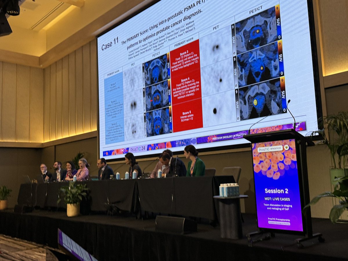 #PSMA SUVmax on localised #Prostate Ca is not everything… we should also consider the PRIMARY score! Intraprostatic analysis should take into account SUV parameters along with anatomical location of lesion. 🗺️💡 @drlouiseemmett @ButeauJames @DrMHofman @DrDanielMoon #ProsTIC24