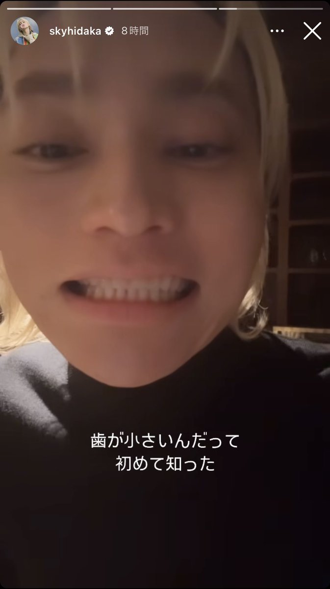 ___Ruu12's tweet photo. 人より歯が小さかったのね、
多いとか言って面白がってごめんね https://t.co/LL1yZqV9bN