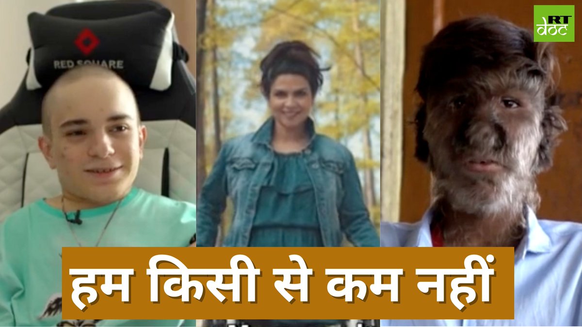 RTDocHindi's tweet photo. बालों से भरा शरीर, जरूरत से ज्यादा लंबी टांगे या ज़रूरत जितनी भी लंबाई नहीं... कभी-कभी एक शारीरिक कमी भी इंसान को सबसे अनोखा बना देती है।

https://t.co/ZSvt5T4lQF

#Different #Documentary #India #RTDocumentary #inspiration https://t.co/FMpQOrrlz3