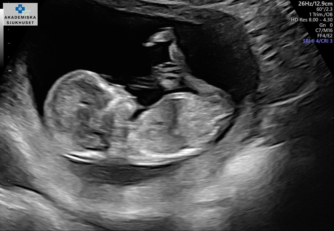 OneHandedOnly tweet media