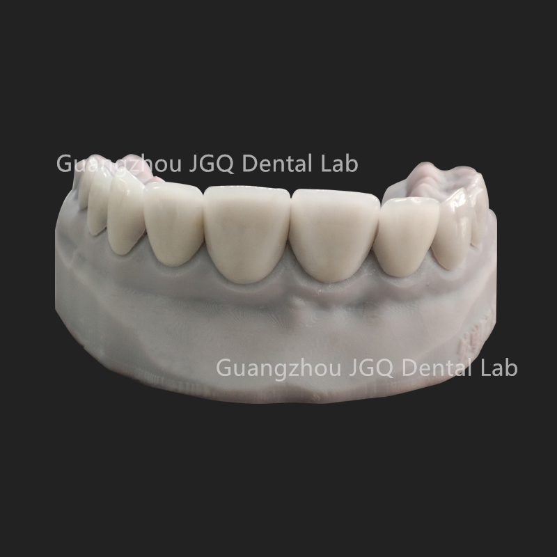 ZhaoJason57098's tweet photo. Veneers can camouflage:
*Chipped or broken teeth.
*Diastema
*Stains that don’t improve with teeth whitening.
*Teeth that are too small.
*Misshapen teeth.

Guangzhou JGQ Dental Lab has professional technicians, to be your best outsourcing Partner.

https://t.co/NBoq2joPIN https://t.co/PmfHeXoy88