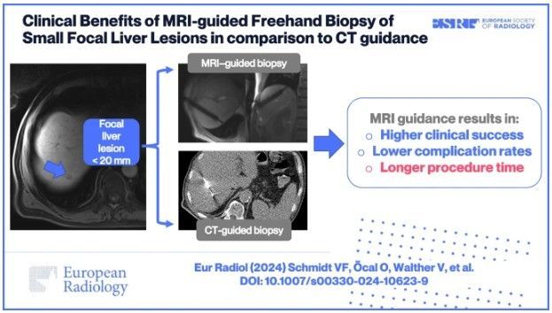 ESRJournals's tweet photo. This #EuropeanRadiology study compared clinical success, procedure time, &amp; complication rates between MRI-guided &amp; CT-guided real-time biopsies of small focal liver lesions, finding MR guidance to be superior to CT guidance. (Vanessa F. Schmidt et al.)

🔗 https://t.co/EklnLyrCT5 https://t.co/8gZmlAWSKZ