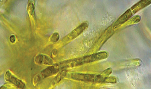 Molecular data and culture observations show that the microfilamentous marine alga Uronema marinum is a member of the genus Okellya #Cladophorales #Chlorophyta cryptogamie.com/algologie/45/3