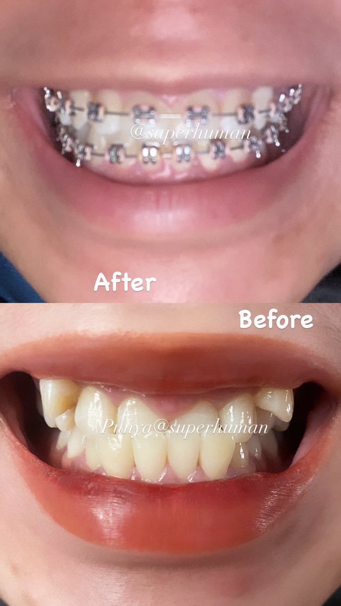 ashesofsun tweet media