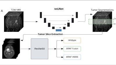 Noninvasive Molecular Subtyping of Pediatric Low-Grade Glioma with Self-Supervised Transfer Learning doi.org/10.1148/ryai.2… @BenjaminKannMD @BrighamWomens @DHaasKogan #NeuroRad #glioma #DeepLearning