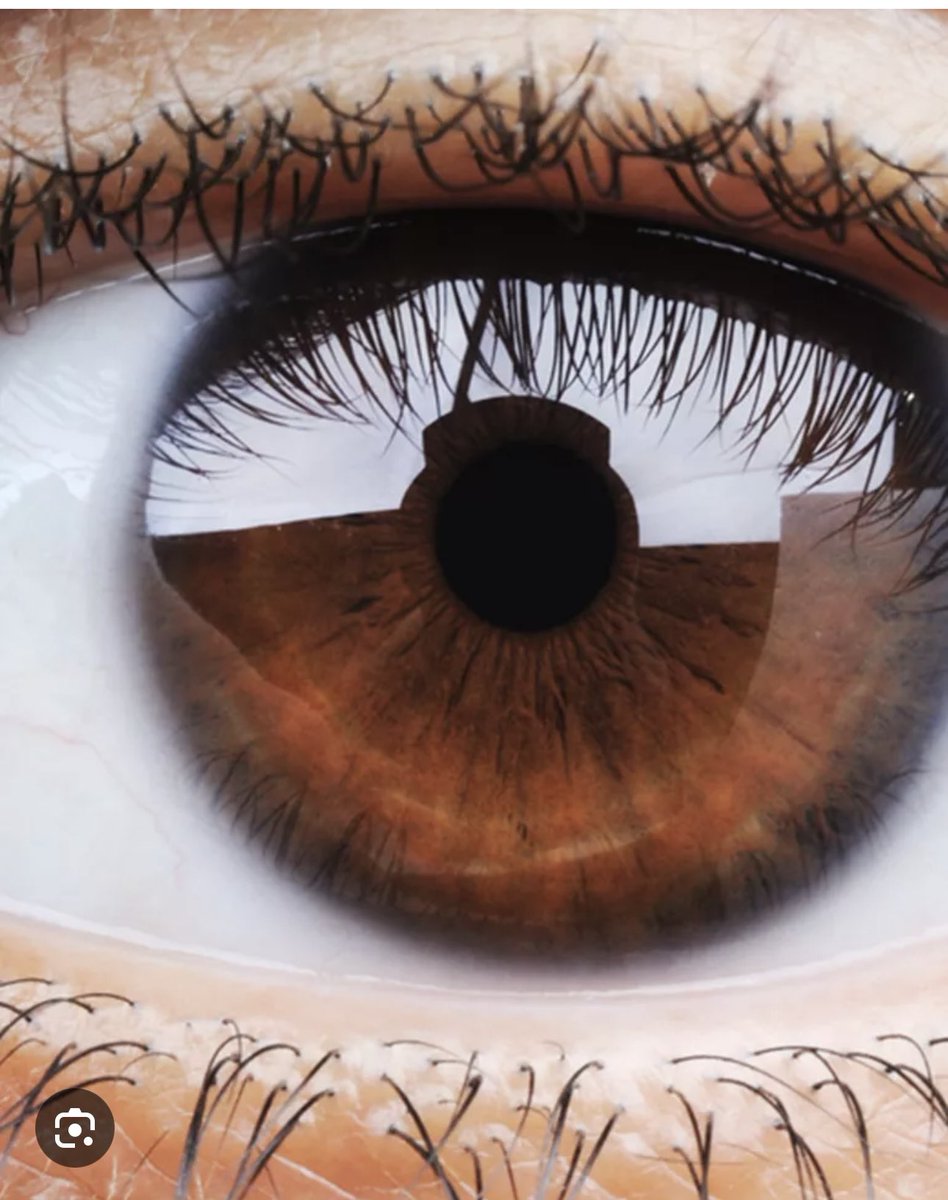 Quand nous les myopes on vous dit qu'on ne vous a pas vu en route sans nos lunettes. Des fois on ment, on veut  juste pas s’arrêter pour vous saluer ni taper la causette quand vous êtes assez proche de nous. Le temps c’est de l’argent #myope #lunettes