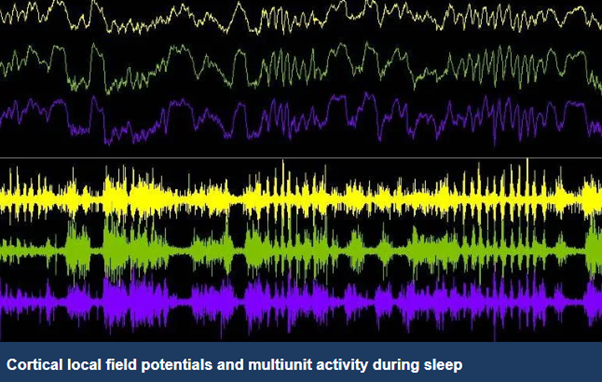 Today is #worldsleepday and DPAG's @VVyazovskiy gave a talk at #Brainconf2024 @Brain1878 @KavliOxford @OxSCNi To learn more about his sleep-related research check out dpag.ox.ac.uk/research/vyazo…