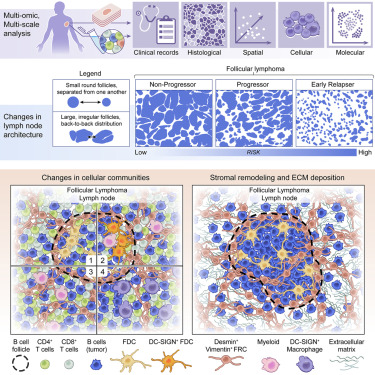 Multi-omic profiling of follicular lymphoma reveals changes in tissue architecture and enhanced stromal remodeling in high-risk patients dlvr.it/T46gDM