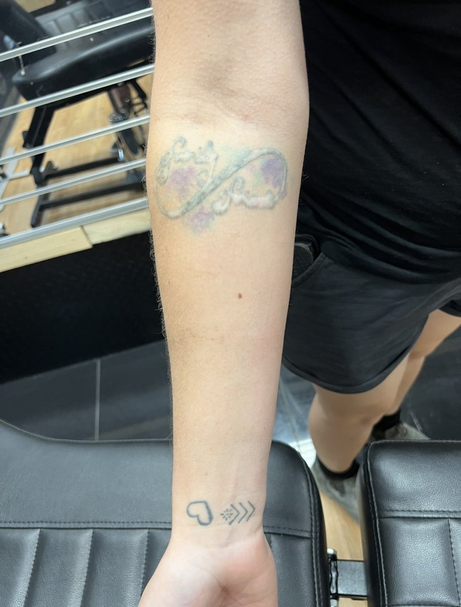 DOOMSDAYTATT00's tweet photo. cover up over bad laser tattoo removal scar https://t.co/M9wSJiWvkh