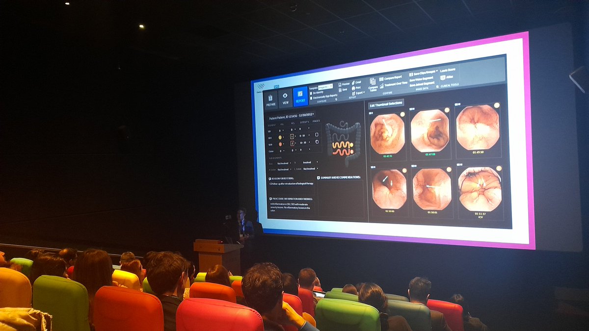 State of the art lectures on ERAS in IBD by Dr Vigorita @VVigorita - and Medical treatment of IBD by Dr Phil Hendy Anastomotic Techniques in IBD surgery - 2nd edition in our Medicinema at @ChelwestFT @cwpluscharity @Dukes_Club @BritSocGastro @YouESCP @ACPGBI @ibdpouchsurgery