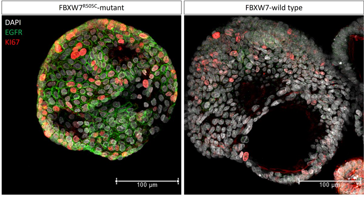 Researchers from the Organoid group have found a new link between a commonly mutated gene in colon cancer, FBXW7, and EGFR signaling. Read more here: hubrecht.eu/fbxw7-egfr/ @geurts_maarten @HansClevers @sha_gandhi @TheCleversLab